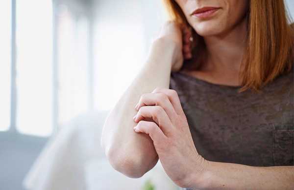 Are You Aware Of These Symptoms Of Plaque Psoriasis?