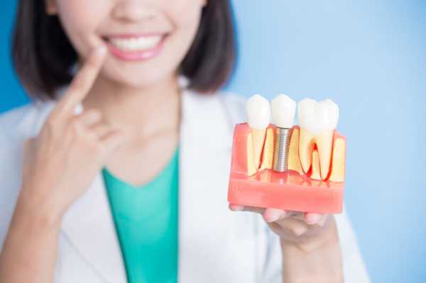 Advanced Dental Implant Solutions: A Trusted Path to Lifelong Oral Health